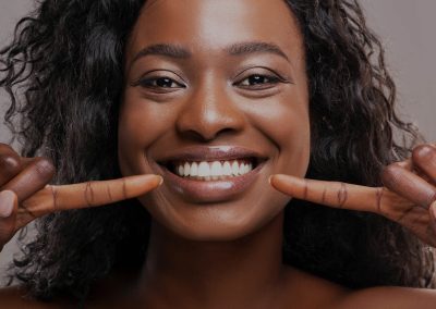 Laser assisted Teeth whitening by Dentistry by design , Bryanston